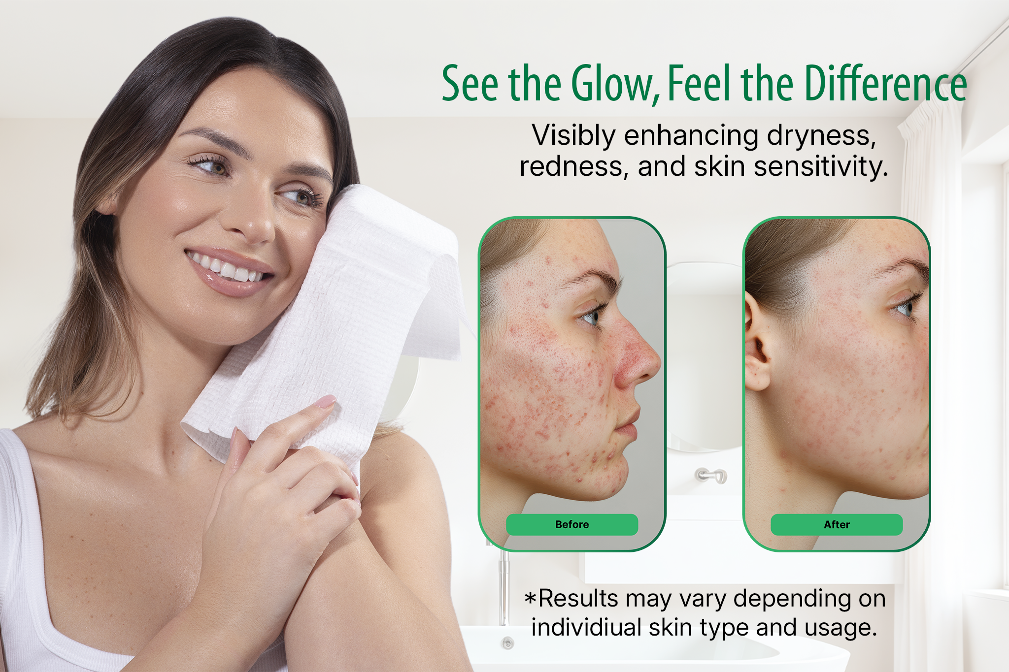 Why Disposable Face Towels Are a Game-Changer for Acne, Eczema, and Sensitive Skin
